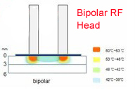 Elos IPL +bipolar IPL の毛の取り外しは IPL 毛の取り外しレーザーを機械で造ります